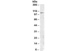 Western blot testing of human substantia nigra lysate with MTHFD1 antibody at 1ug/ml. (MTHFD1 Antikörper)