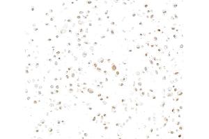 Immunocytochemistry (ICC) image for anti-Interferon, gamma-Inducible Protein 16 (IFI16) (AA 350-400) antibody (ABIN7795821)