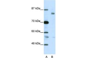 Western Blotting (WB) image for anti-Leucine-Zipper-Like Transcription Regulator 1 (LZTR1) antibody (ABIN2461800) (LZTR1 Antikörper)
