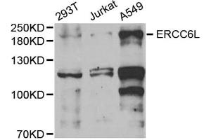 Western blot analysis of extracts of various cell lines, using ERCC6L antibody (ABIN6134675, ABIN6140273, ABIN6140275 and ABIN6221741) at 1:1000 dilution. (ERCC6L Antikörper  (AA 300-400))