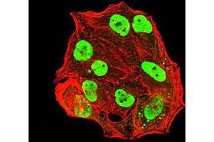 Immunofluorescence analysis of Hela cells using ESR1 mouse mAb (green). (Estrogen Receptor alpha Antikörper  (AA 2-185))
