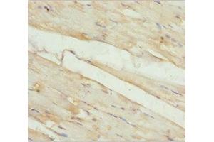 Immunohistochemistry of paraffin-embedded human skeletal muscle tissue using ABIN7157248 at dilution of 1:100 (KBTBD3 Antikörper  (AA 1-350))