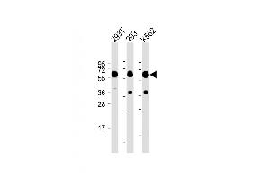 All lanes :SET07 Antibody at 1:2000 dilution Lane 1: 293T whole cell lysate Lane 2: 293 whole cell lysate Lane 3: K562 whole cell lysate Lysates/proteins at 20 μg per lane. (SETD8 Antikörper  (N-Term))