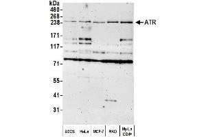 anti-ATR serine/threonine kinase (ATR) (AA 400-450) antibody