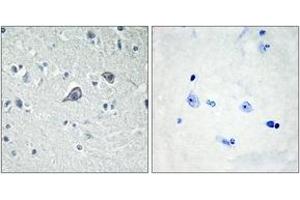 Immunohistochemistry analysis of paraffin-embedded human brain tissue, using ADORA2A Antibody. (Adenosine A2a Receptor Antikörper  (AA 120-169))