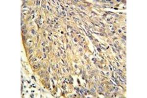Immunohistochemistry (IHC) image for anti-Annexin A1 (ANXA1) (AA 129-158) antibody (ABIN3029969)