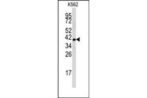 Image no. 1 for anti-Fibrillarin (FBL) (Middle Region) antibody (ABIN357938) (Fibrillarin Antikörper  (Middle Region))