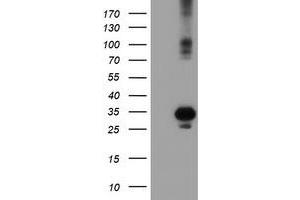 Western Blotting (WB) image for anti-Suppressor of Cytokine Signaling 3 (SOCS3) antibody (ABIN1501063)