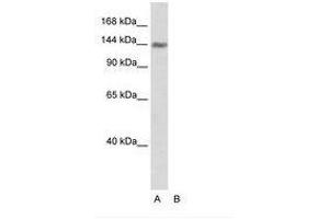 Image no. 1 for anti-Timeless Homolog (TIMELESS) (C-Term) antibody (ABIN202978) (TIMELESS Antikörper  (C-Term))