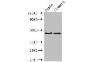 Western Blot Positive WB detected in: Mouse brain tissue, Mouse stomach tissue All lanes: TBC1D20 antibody at 4 μg/mL Secondary Goat polyclonal to rabbit IgG at 1/50000 dilution Predicted band size: 46, 20, 49 kDa Observed band size: 46 kDa (TBC1D2 Antikörper  (AA 1-237))