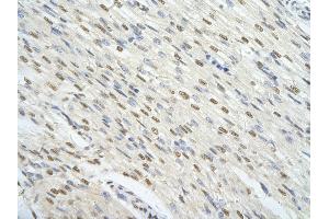 Rabbit Anti-FOXJ3 antibody        Paraffin Embedded Tissue:  Human Heart cell   Cellular Data:  Epithelial cells of renal tubule  Antibody Concentration:   4. (FOXJ3 Antikörper  (Middle Region))