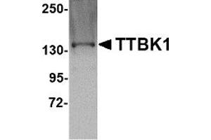 Western Blotting (WB) image for anti-tau Tubulin Kinase 1 (Ttbk1) (C-Term) antibody (ABIN1030783) (TTBK1 Antikörper  (C-Term))