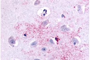 Anti-PAK6 antibody  ABIN1049228 IHC staining of human brain, neurons and glia.