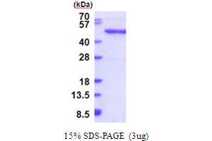SDS-PAGE (SDS) image for Queuine tRNA-Ribosyltransferase Domain Containing 1 (QTRTD1) (AA 1-415) protein (His tag) (ABIN5853951) (QTRTD1 Protein (AA 1-415) (His tag))