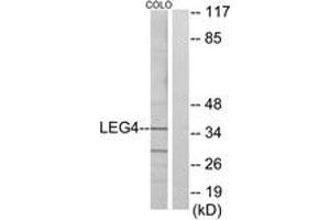 Western blot analysis of extracts from COLO cells, using LEG4 Antibody.