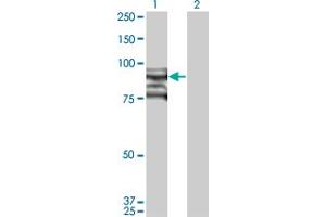 Western Blot analysis of TOP3B expression in transfected 293T cell line by TOP3B monoclonal antibody (M03), clone 1H8. (TOP3B Antikörper  (AA 1-862))