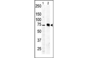 The anti-PKC beta2 Pab is used in Western blot to detect PKC beta2 in Jurkat cell lysate (lane 1) and mouse brain tissue lysate (lane 2). (PKC beta Antikörper  (C-Term))