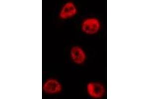 ABIN6273993 staining HepG2 by IF/ICC. (BCL6 Antikörper  (Internal Region))