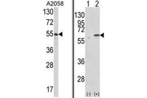 (LEFT) Western blot analysis of PDIA3 Antibody (C-term) in A2058 cell line lysates (35ug/lane). (PDIA3 Antikörper  (C-Term))