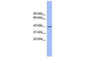 WB Suggested Anti-EXOD1 Antibody Titration: 0. (ERI2 Antikörper  (N-Term))
