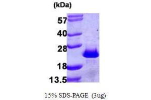 SDS-PAGE (SDS) image for Programmed Cell Death 6 (PDCD6) (AA 1-191) protein (His tag) (ABIN667892) (PDCD6 Protein (AA 1-191) (His tag))