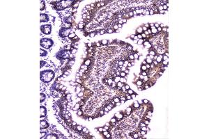 IHC analysis of TANK using anti-TANK antibody (ABIN6719508). (TANK Antikörper)
