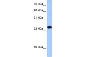 Western Blotting (WB) image for anti-Eukaryotic Translation Initiation Factor 4E Family Member 3 (EIF4E3) antibody (ABIN2462352)