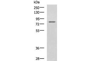Western blot analysis of Rat liver tissue lysate using DHX58 Polyclonal Antibody at dilution of 1:800 (DHX58 Antikörper)