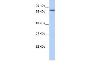 WB Suggested Anti-TRIM29 Antibody Titration:  0. (TRIM29 Antikörper  (N-Term))