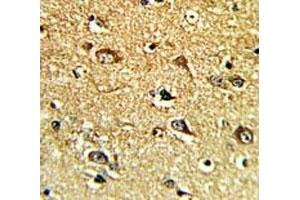 Immunohistochemistry (IHC) image for anti-Tyrosine Hydroxylase (TH) (AA 486-514) antibody (ABIN3029766)