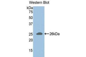 Western Blotting (WB) image for anti-ADAM Metallopeptidase with Thrombospondin Type 1 Motif, 1 (ADAMTS1) (AA 258-467) antibody (ABIN1857895)