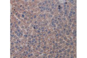 Used in DAB staining on fromalin fixed paraffin- embedded liver tissue