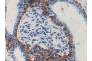 Immunohistochemistry (IHC) image for anti-C-Type Lectin Domain Family 4, Member M (CLEC4M) (AA 242-399) antibody (ABIN7441907)