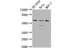 Western Blot Positive WB detected in: SH-SY5Y whole cell lysate, Hela whole cell lysate, MCF-7 whole cell lysate All lanes: RANBP10 antibody at 2. (RANBP1 Antikörper  (AA 3-165))