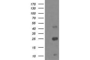Western Blotting (WB) image for anti-Aldehyde Dehydrogenase 1 Family, Member A3 (ALDH1A3) (AA 1-100), (AA 413-512) antibody (ABIN2715886)