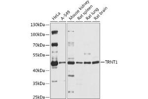 Western blot analysis of extracts of various cell lines, using TRNT1 antibody (ABIN7271005) at 1:1000 dilution. (Trnt1 Antikörper  (AA 135-434))