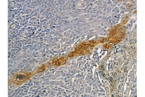 anti-Brain-Specific Angiogenesis Inhibitor 2 (BAI2) (C-Term) antibody