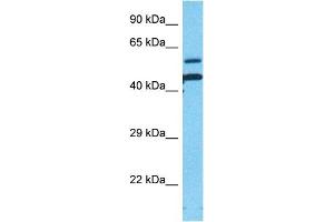 Host:  Rabbit  Target Name:  ACTBM  Sample Type:  Fetal Lung lysates  Antibody Dilution:  1ug/ml