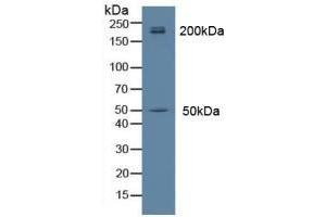 Detection of MYH14 in Rat Brain Tissue using Polyclonal Antibody to Myosin Heavy Chain 14, Non Muscle (MYH14) (Myosin Antikörper  (AA 1069-1331))