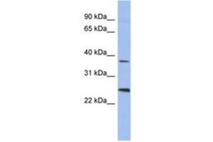 Image no. 1 for anti-Melanoma Antigen Family B, 2 (MAGEB2) (AA 71-120) antibody (ABIN6744051) (MAGEB2 Antikörper  (AA 71-120))