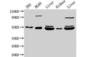 Western Blot Positive WB detected in: 293 whole cell lysate, HL60 whole cell lysate, Rat liver tissue, Mouse kidney tissue, Mouse liver tissue All lanes: NADK2 antibody at 4 μg/mL Secondary Goat polyclonal to rabbit IgG at 1/50000 dilution Predicted band size: 50, 46, 32 kDa Observed band size: 50, 46 kDa (NADK2 Antikörper  (AA 16-156))