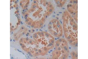 Used in DAB staining on fromalin fixed paraffin- embedded kidney tissue (LYPLA2 Antikörper  (AA 1-196))