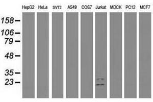 Image no. 1 for anti-Guanylate Kinase 1 (GUK1) antibody (ABIN1498566)