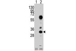 Western blot analysis of CD8A (arrow) using rabbit CD8A polyclonal antibody . (CD8 alpha Antikörper  (N-Term))