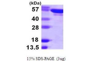 Tyrosyl-tRNA Synthetase (Yars) (AA 1-528) protein (His tag)