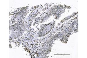 IHC analysis of FOXK1 using anti-FOXK1 antibody (ABIN7600295). (Foxk1 Antikörper  (AA 175-671))