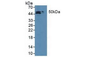 Western blot analysis of (1) Human HepG2 cells and (2) Human HCT116 cell. (MAT2A Antikörper  (AA 176-395))
