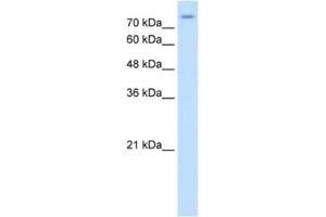 Western Blotting (WB) image for anti-Solute Carrier Family 20 (Phosphate Transporter), Member 2 (SLC20A2) antibody (ABIN2462564) (SLC20A2 Antikörper)