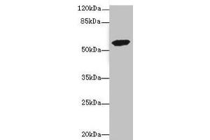 Western blot All lanes: ETFDH antibody at 3. (ETFDH Antikörper  (AA 318-617))