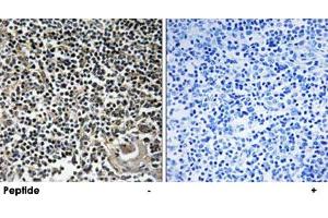 Immunohistochemistry analysis of paraffin-embedded human thymus gland tissue using CBLN4 polyclonal antibody . (CBLN4 Antikörper)